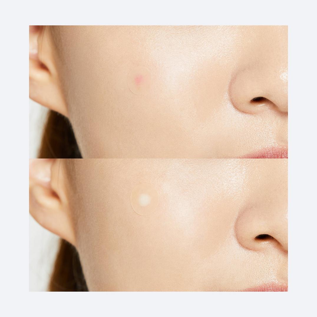 COSRX Acne Pimple Master Patch - Original Care