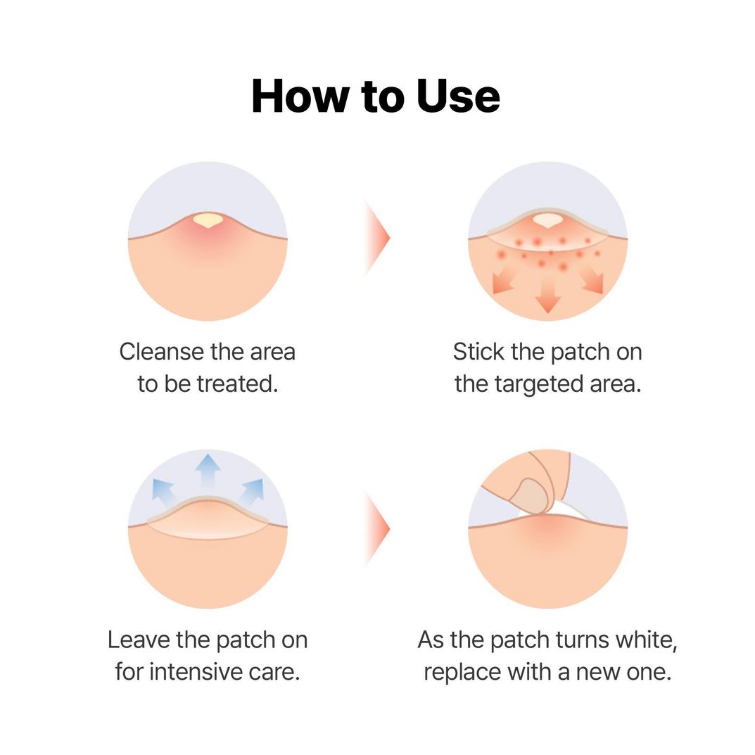 COSRX Master Patch Set - 90 Hydrocolloid Patches