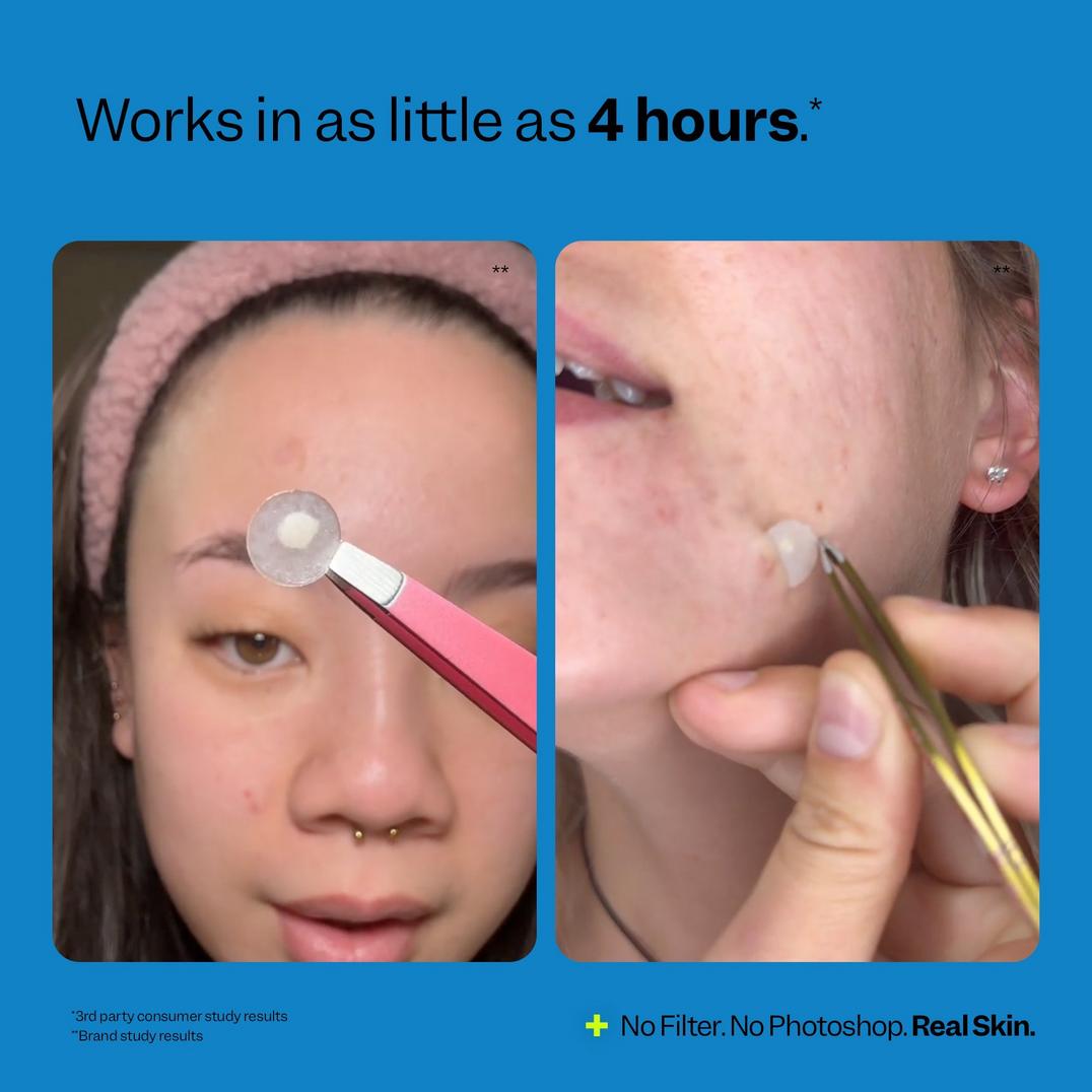 Peach Slices Acne Spot Dots