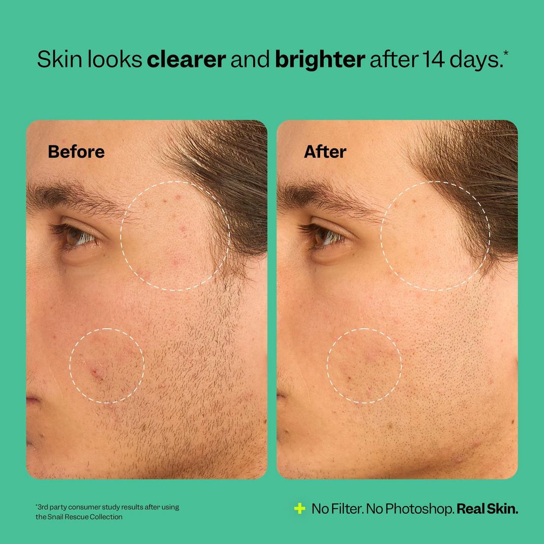 Peach Slices Snail Rescue Blemish Busting Toner