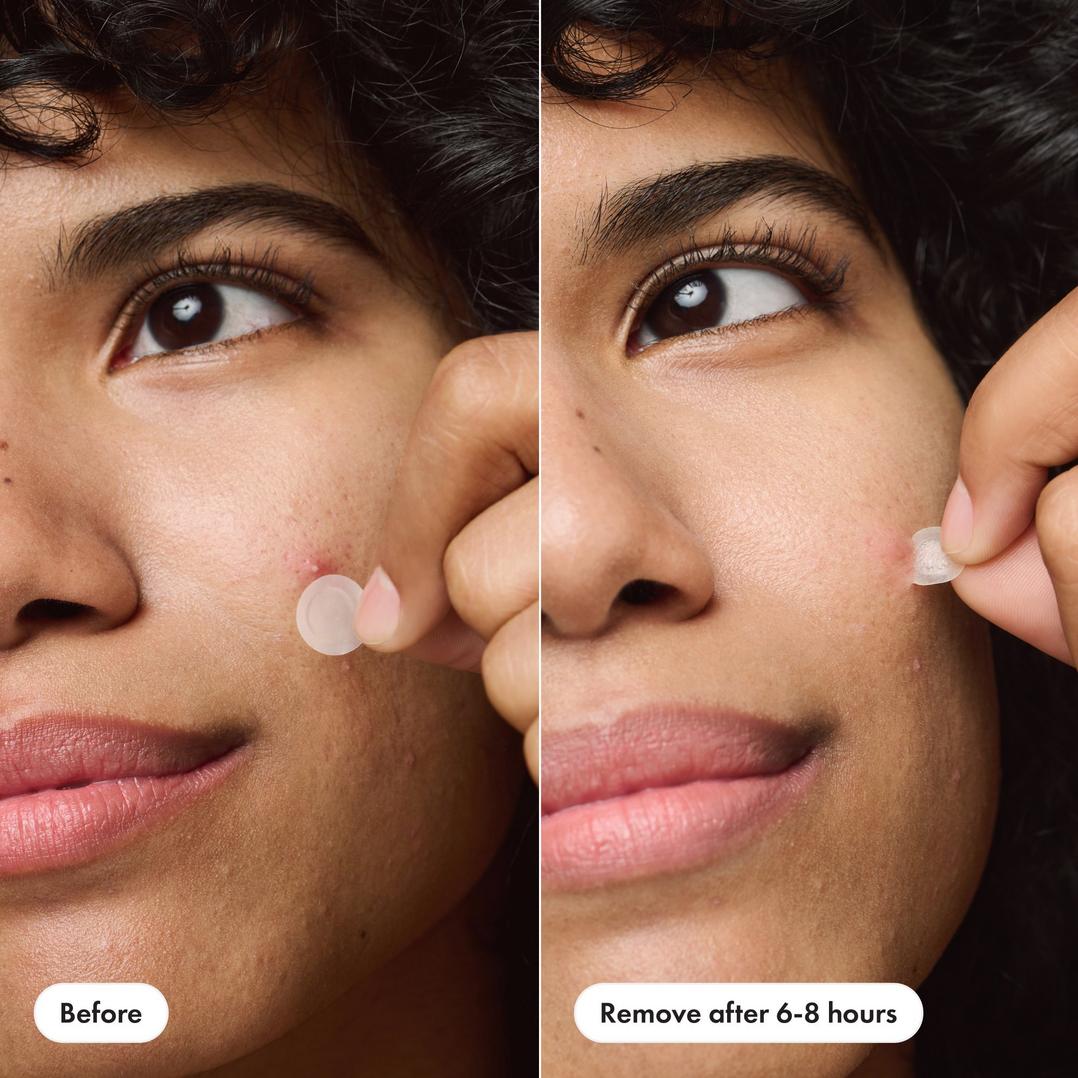 Hero Cosmetics Mighty Patch Duo Original & Invisible+ Patches