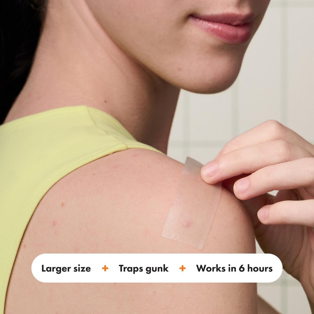 Hero Cosmetics Mighty Patch Surface Acne Pimple Patches