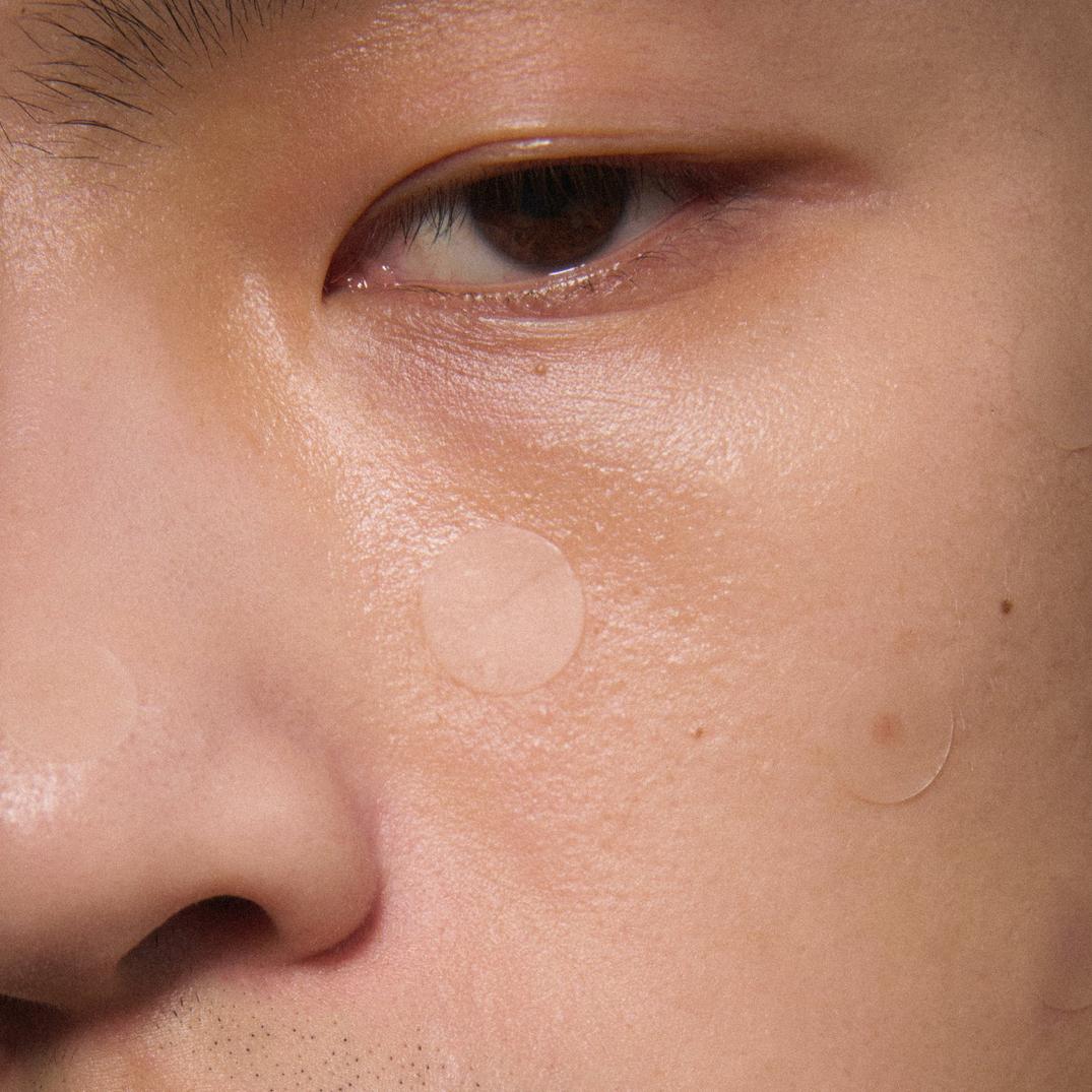 good light Luna Fast Acting Pimple Patches