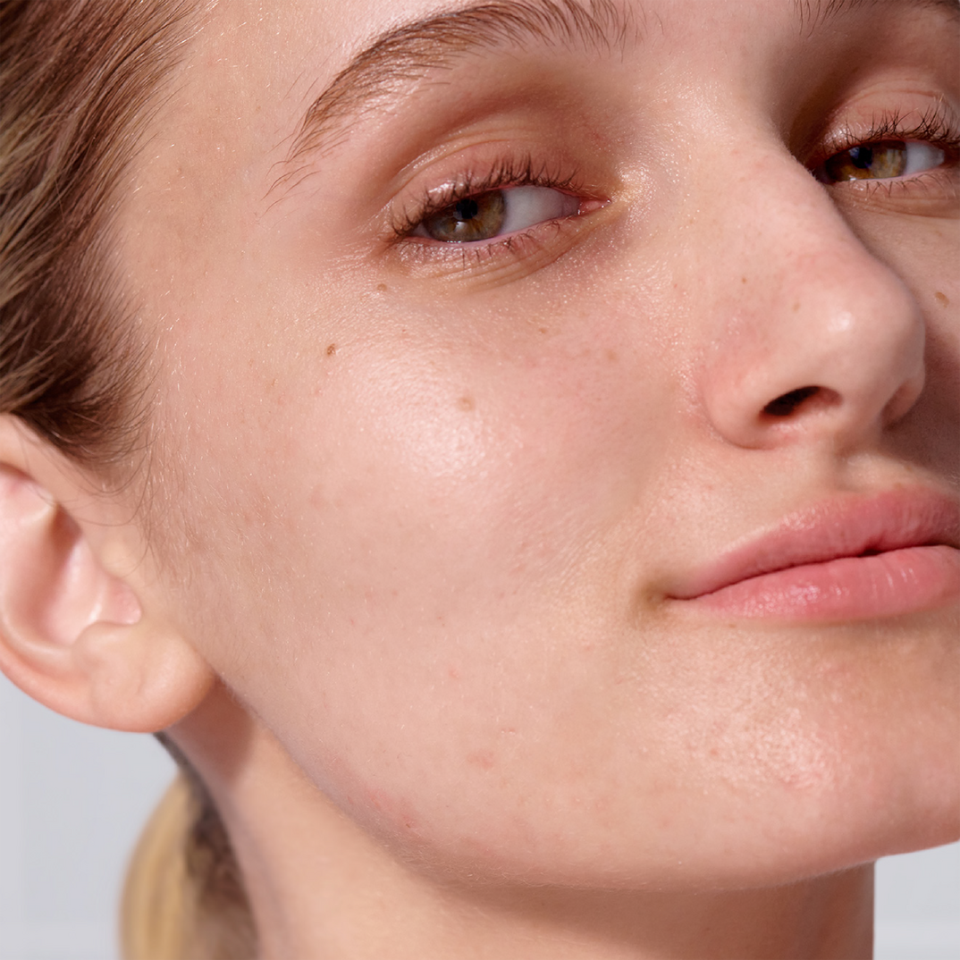 Hero Cosmetics Pore Release Blackhead Solution