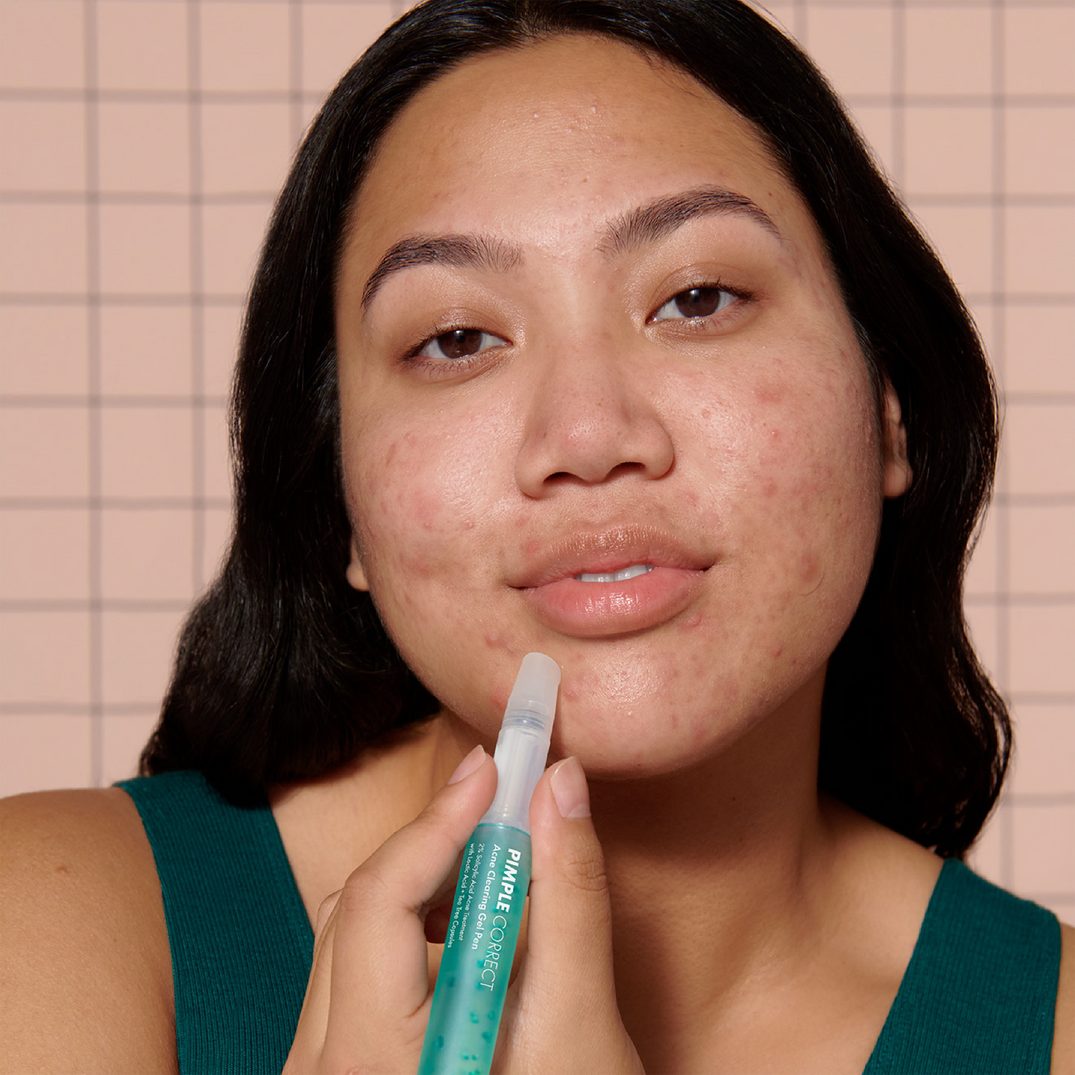 Hero Cosmetics Pimple Correct Acne Clearing Gel Pen