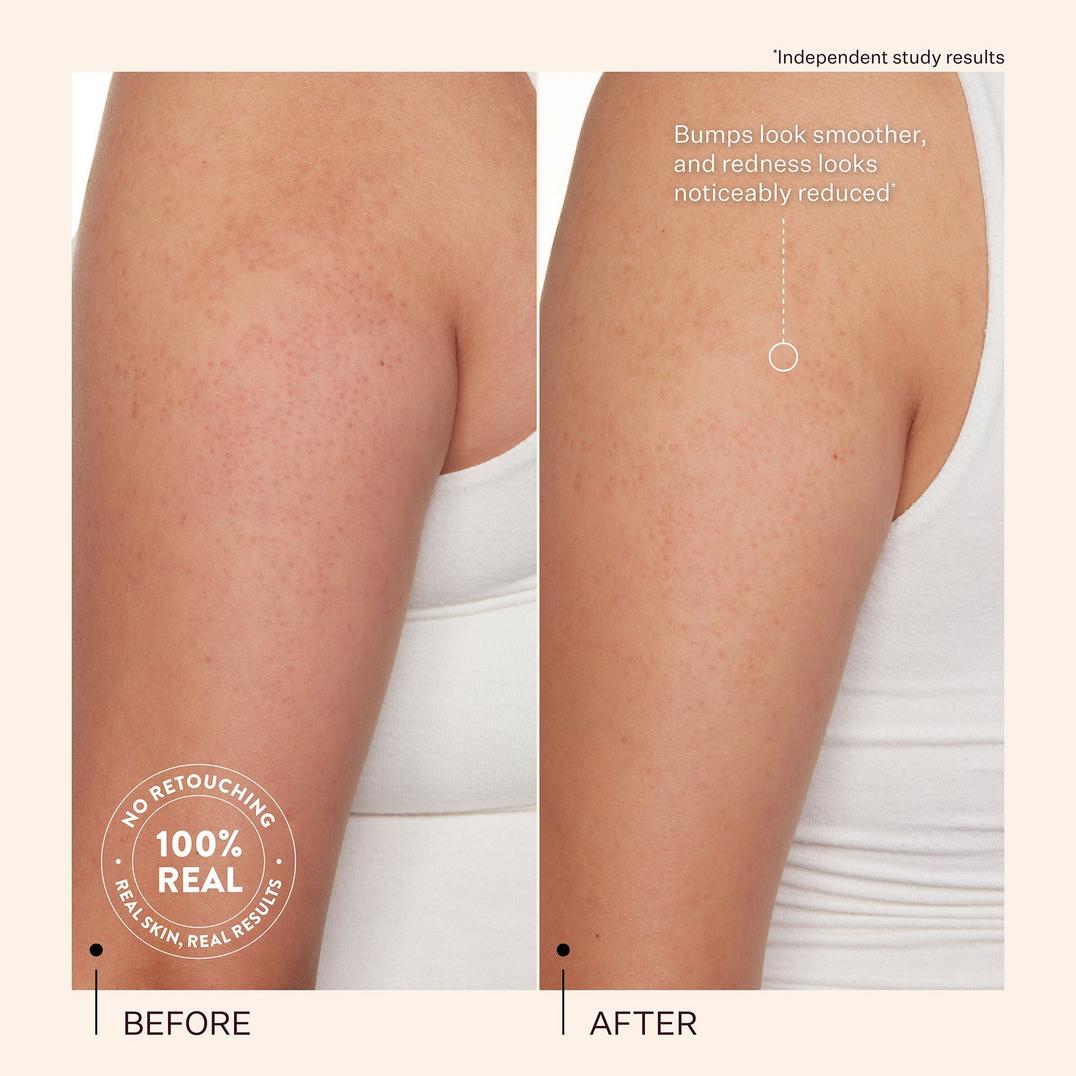 PEACH & LILY KP Bump Boss Smoothing Body Lotion