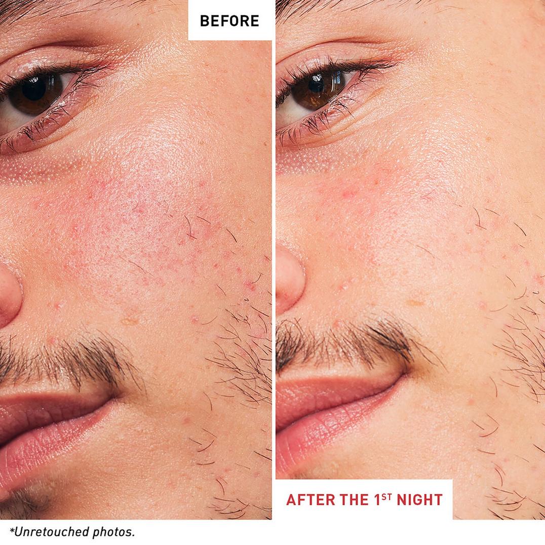 Erborian Skin Therapy Multi-Perfecting Night Oil-Serum