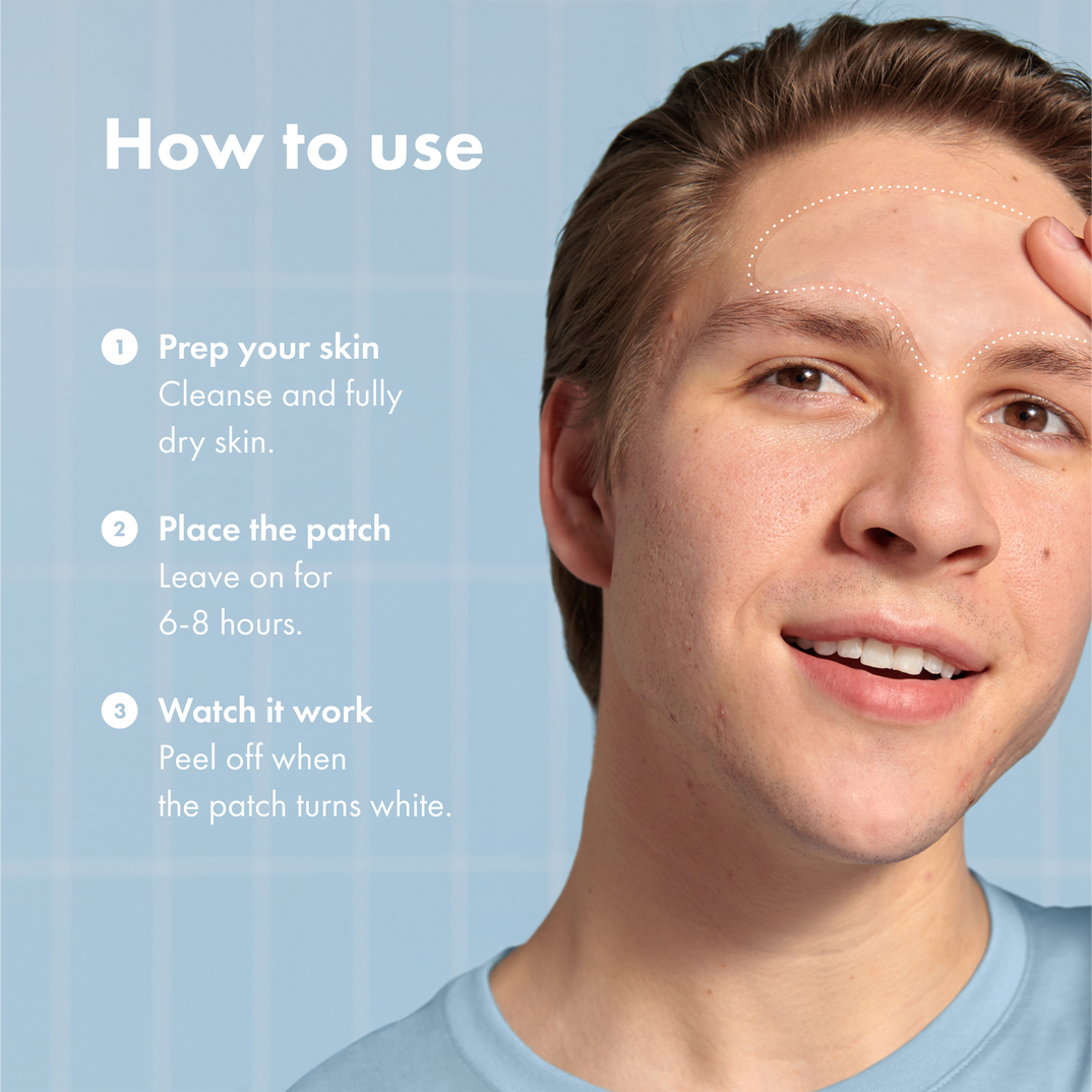 Hero Cosmetics Mighty Patch Forehead Pimple Patches
