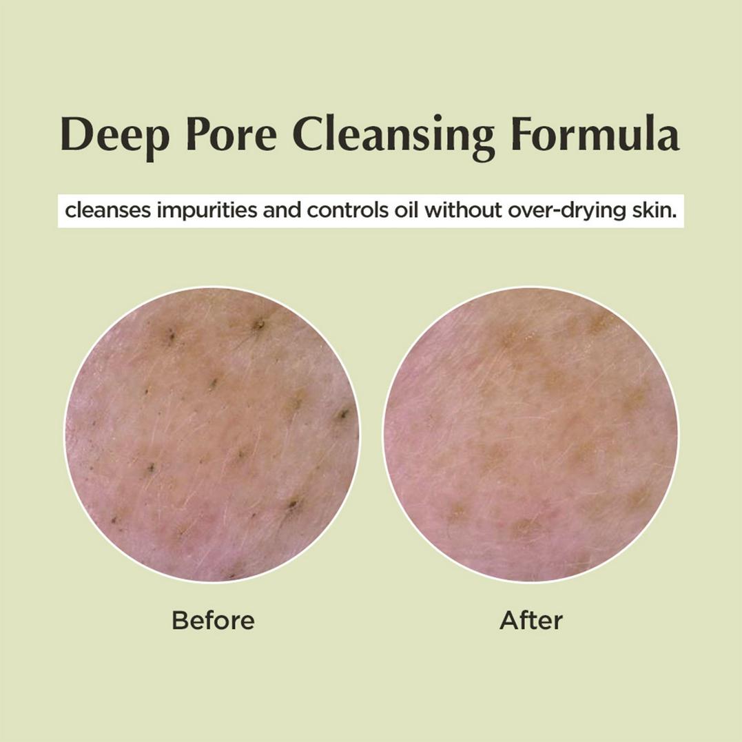 ma:nyo Deep Pore Cleansing Soda Foam
