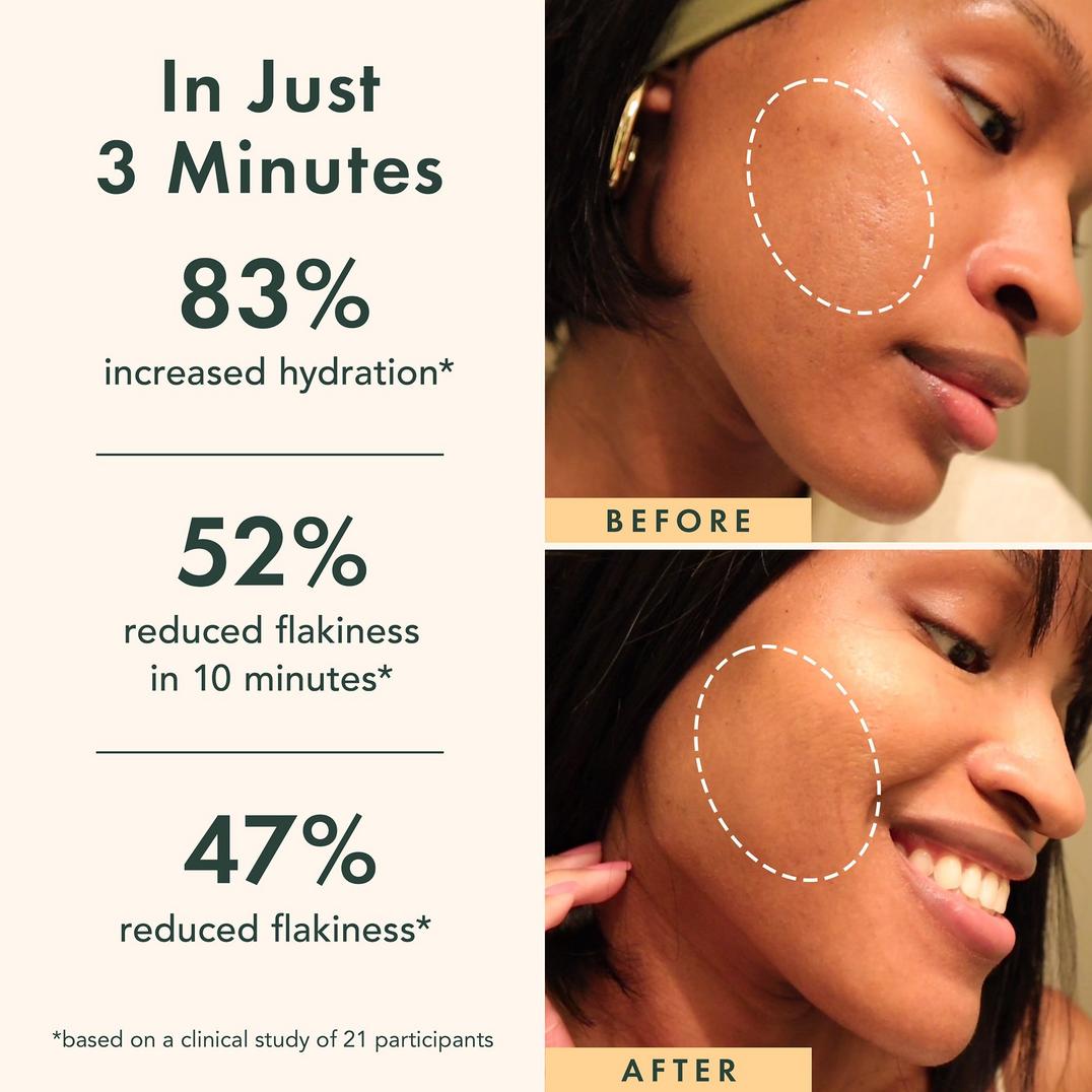 Rael Miracle Clear Brightening Triple Acid Exfoliant