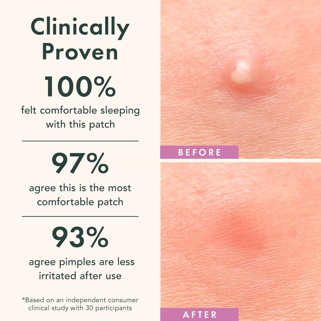 Rael Miracle Patch Overnight Spot Cover