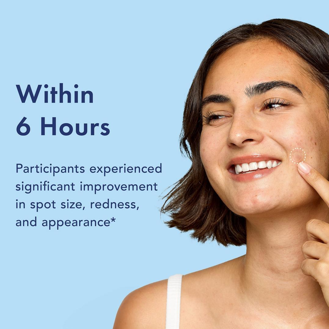 Rael Miracle Patch Retinol Spot Cover