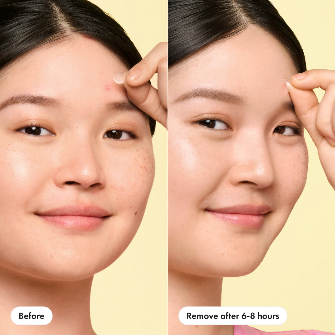 Hero Cosmetics Mighty Patch Mini Invisible+