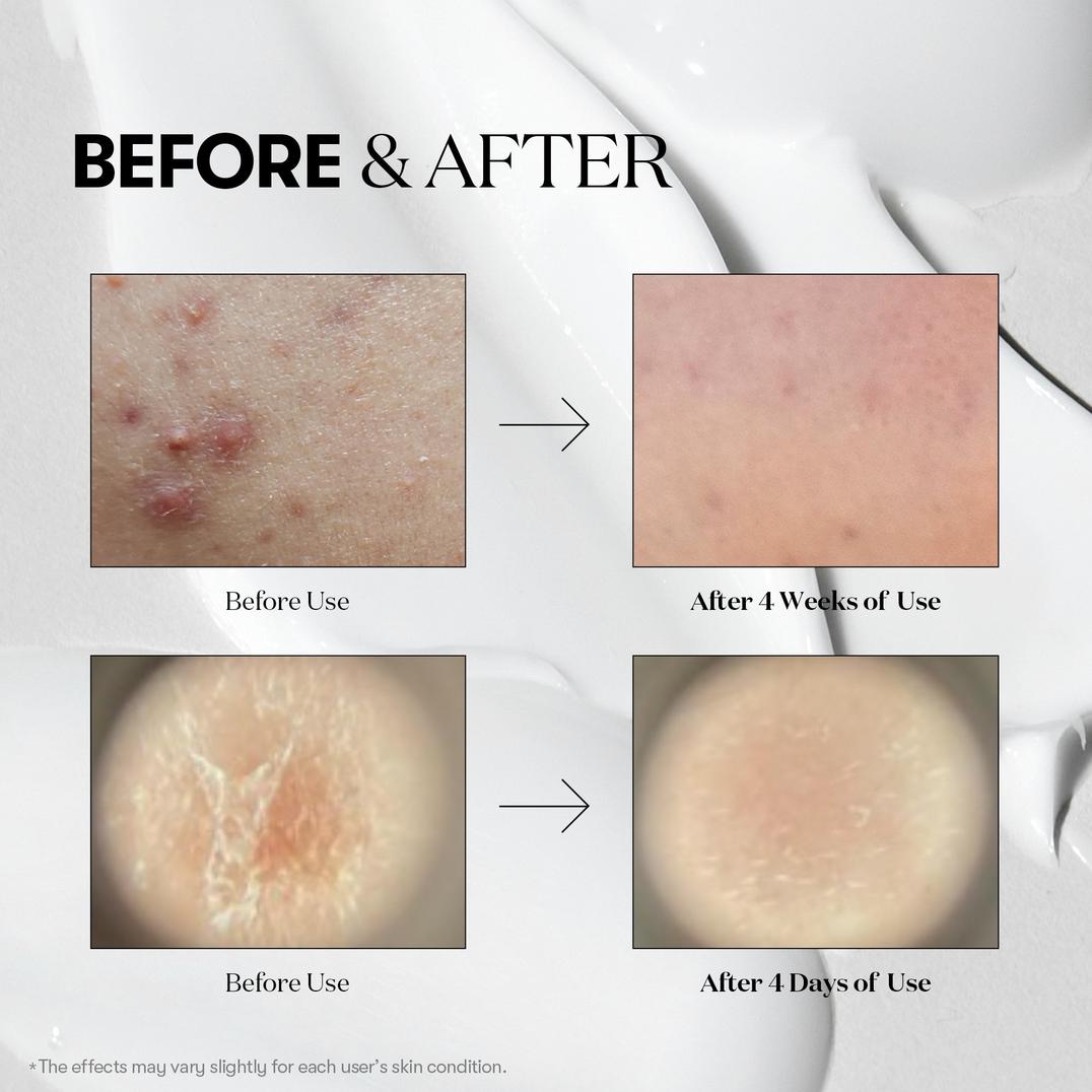 VT Cosmetics Reedle Shot 50