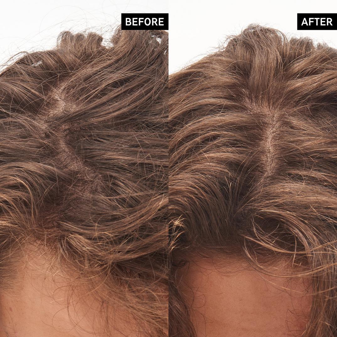 The INKEY List Glycolic Acid Exfoliating Scalp Scrub
