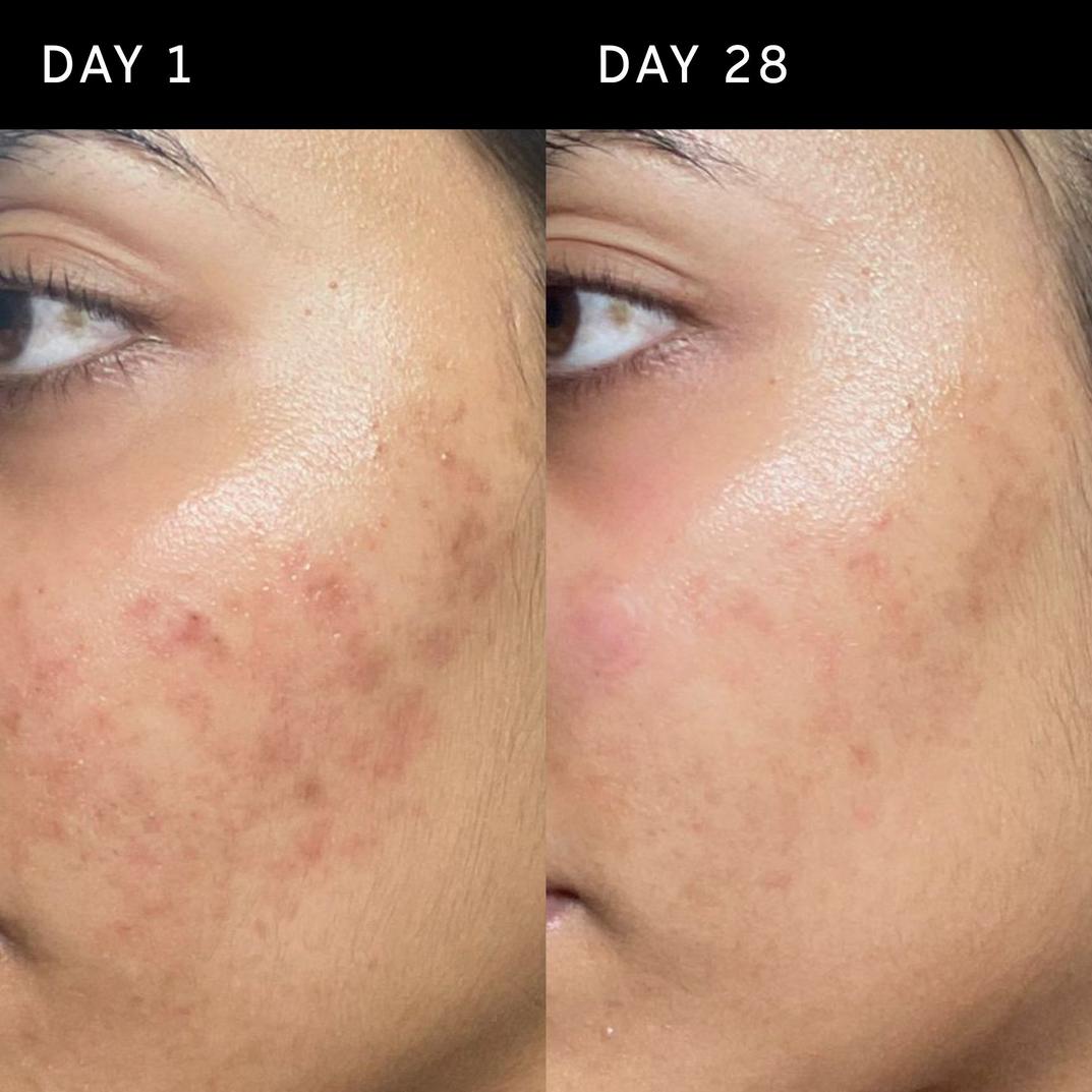 The INKEY List Ectoin Hydro-Barrier Serum