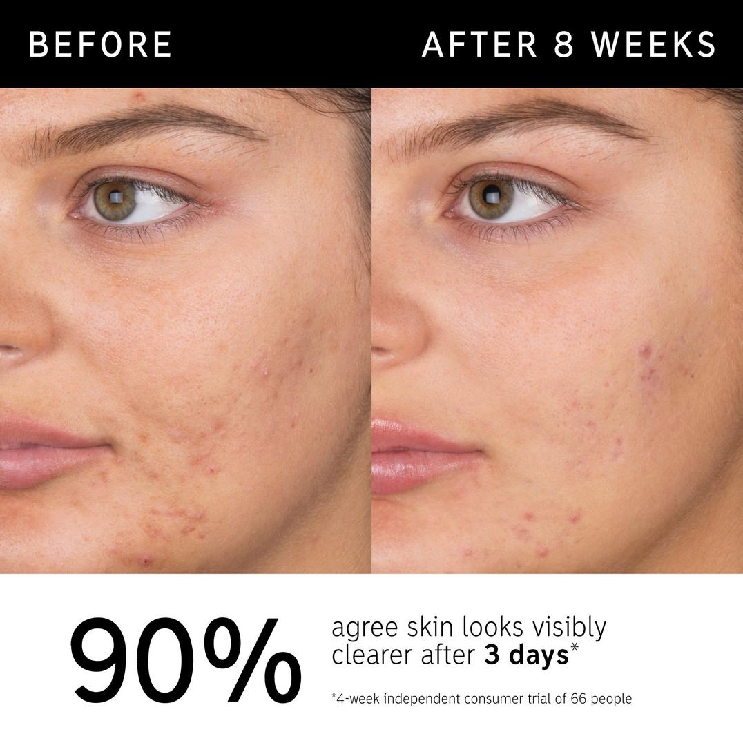 The INKEY List Salicylic Acid Acne + Blackhead Cleanser