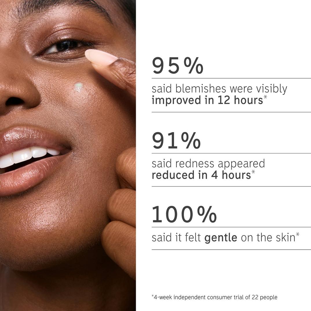 The INKEY List Succinic Acid Acne Treatment
