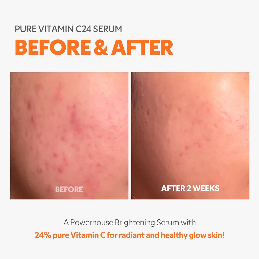 TIRTIR Pure Vitamin C24 Serum