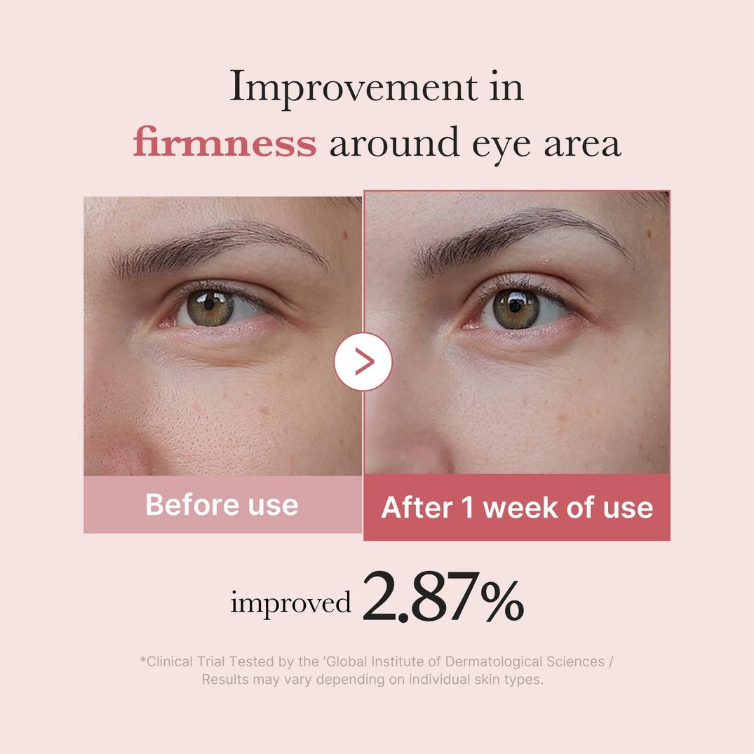 medicube PDRN Pink Peptide Eye Serum