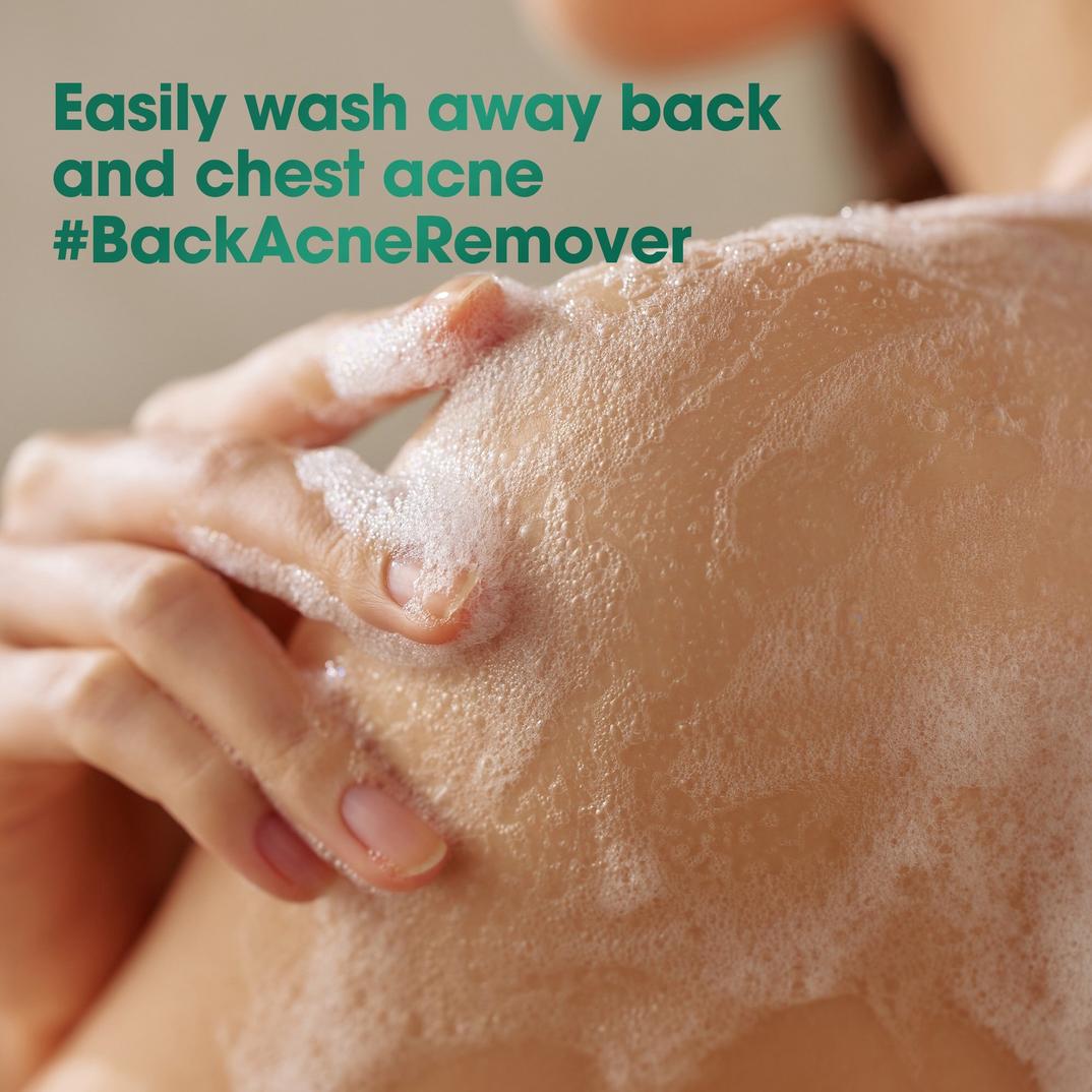 SOME BY MI AHA BHA PHA 30 Days Miracle Acne Clear Body Cleanser