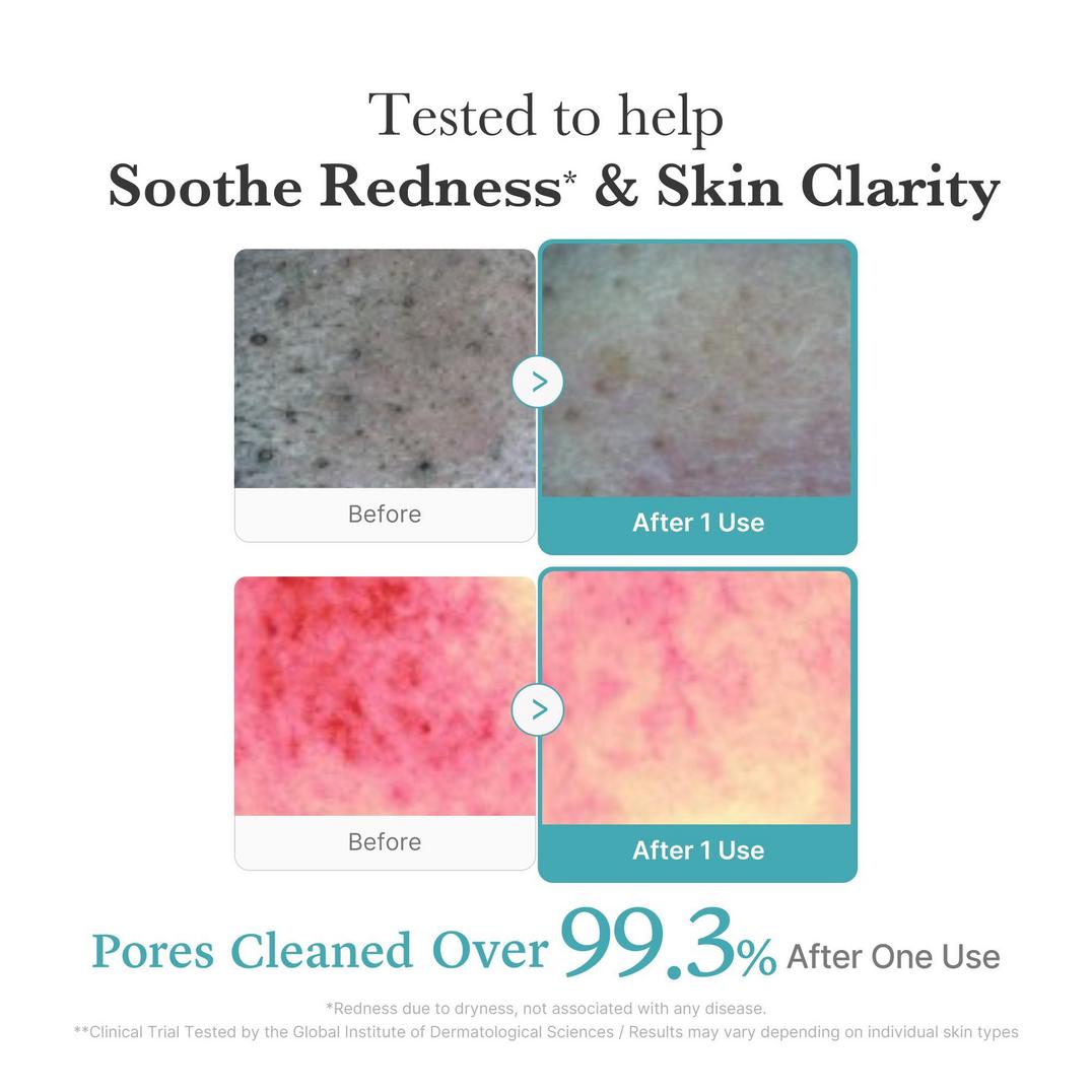 medicube Azelaic Acid Niacinamide Deep Clean Whip Cleanser