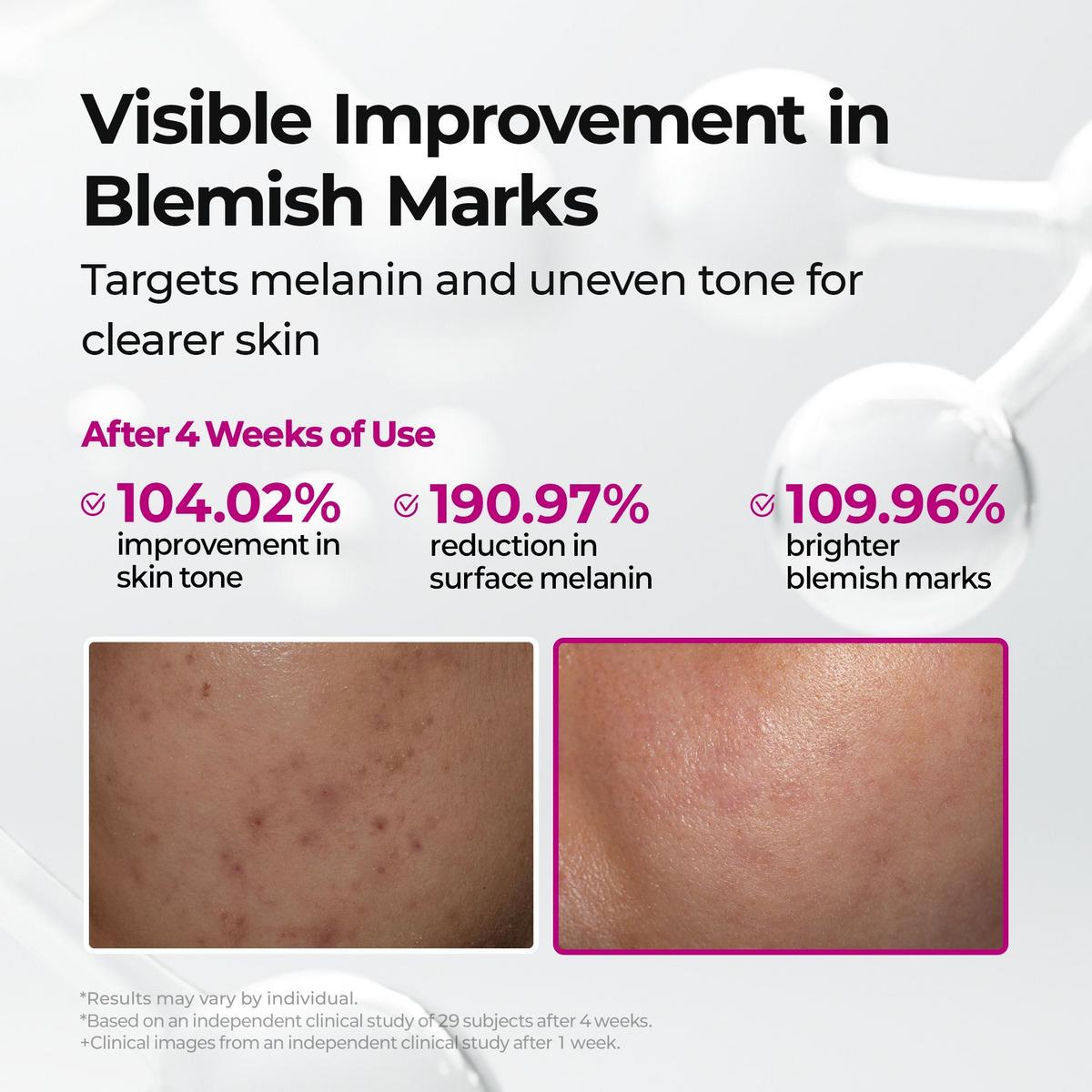 Dr. Melaxin Picotonic Shot Pigmentation Serum