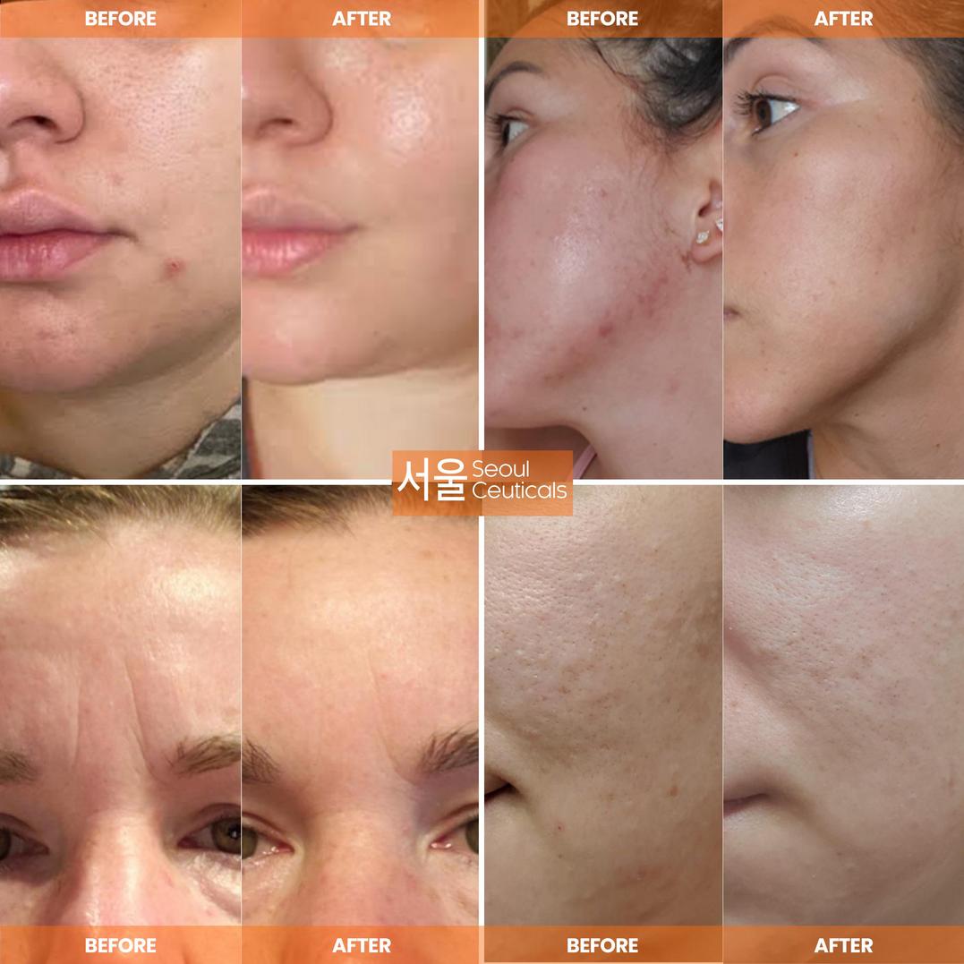 Seoul Ceuticals Korean Skin Care Multi-Function All-In-One Anti-Aging Snail Repair Cream