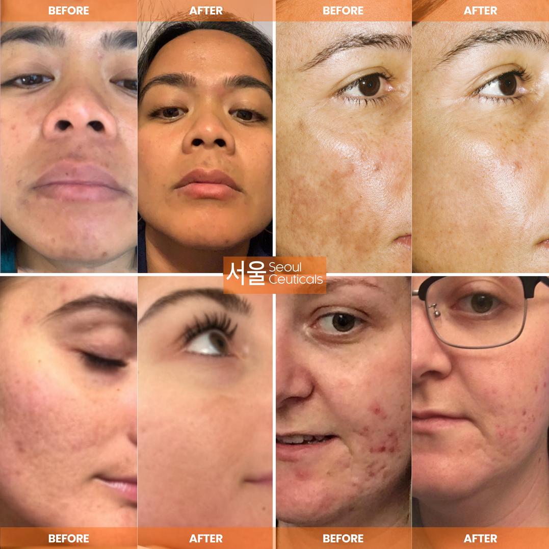 Seoul Ceuticals Korean Skin Care Vitamin C Serum Day Glow Serum