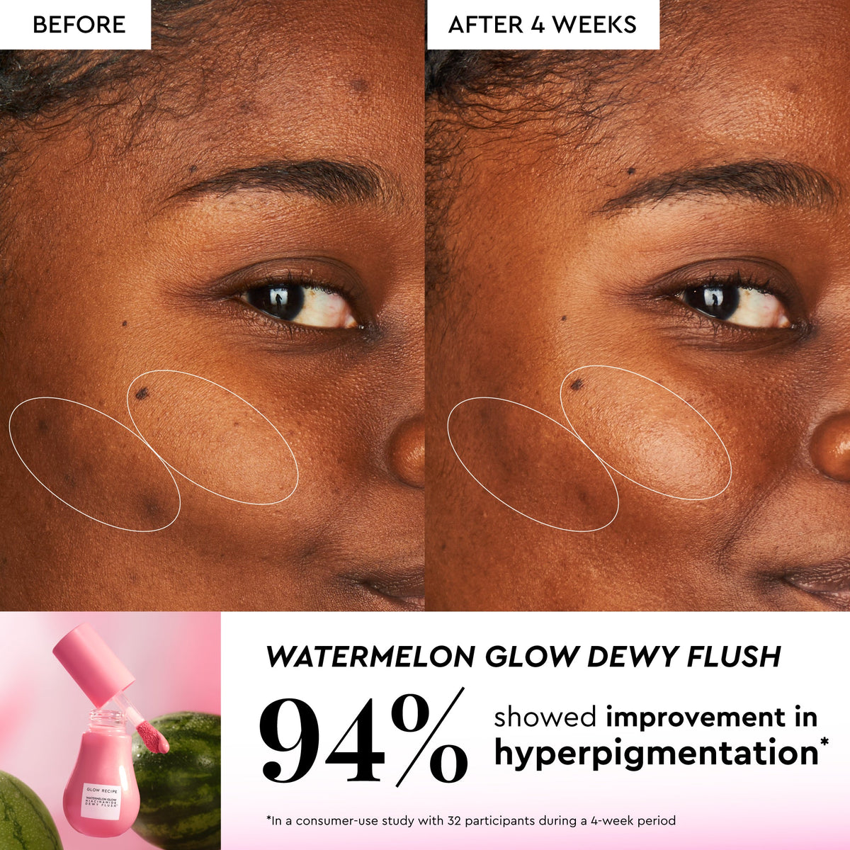 Glow Recipe Watermelon Glow Best-Sellers Kit
