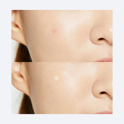 COSRX Acne Pimple Master Patch - Original Care
