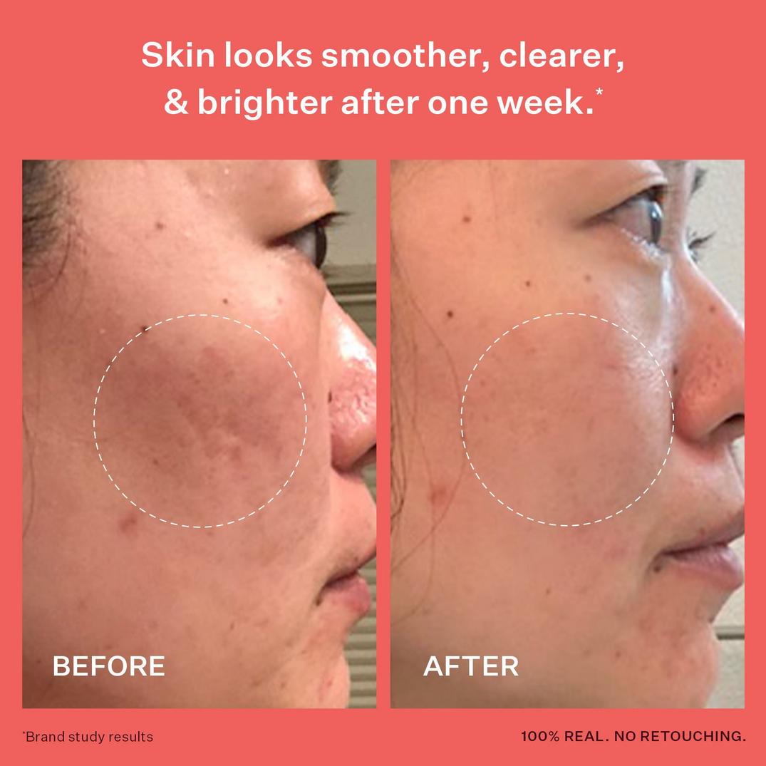 PEACH & LILY Glass Skin Refining Serum