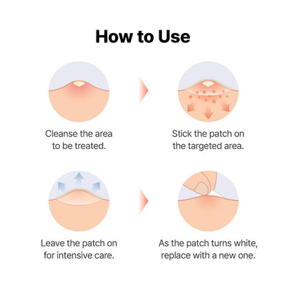 COSRX Master Patch Hydrocolloid Patches Set