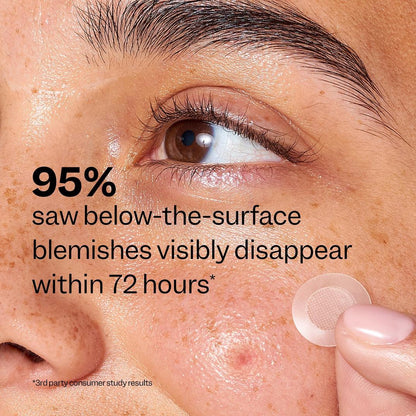 Peach Slices Deep Blemish Microdarts