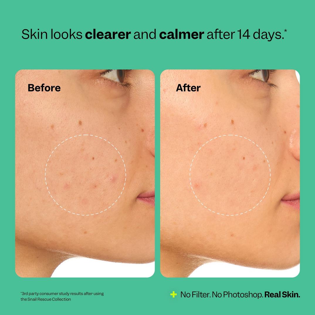 Peach Slices Snail Rescue Intensive Wash-Off Jelly Mask