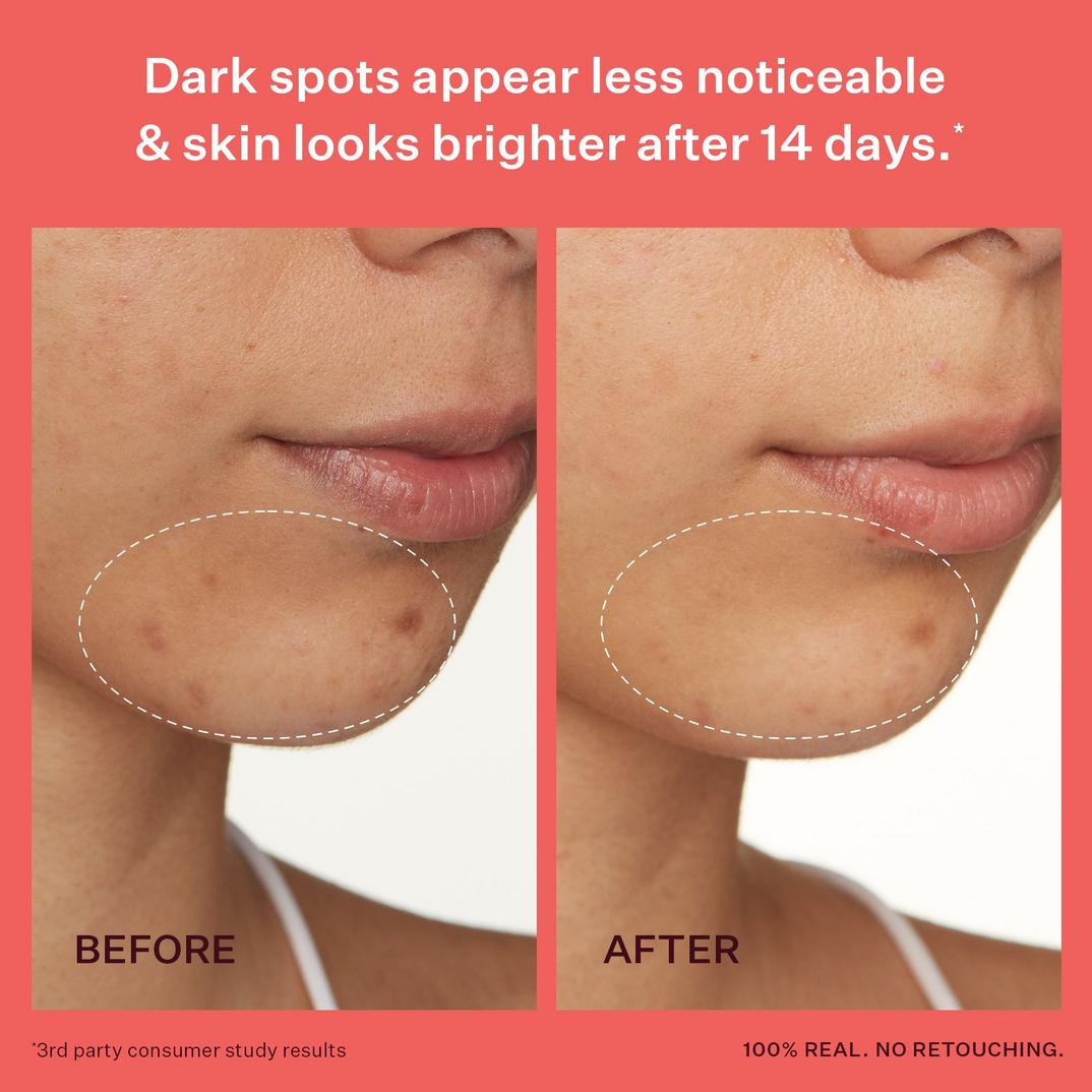 PEACH & LILY Transparen-C Pro Spot Treatment