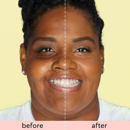 Tarte Skin Treat Poreless Tinted Moisturizer SPF 20