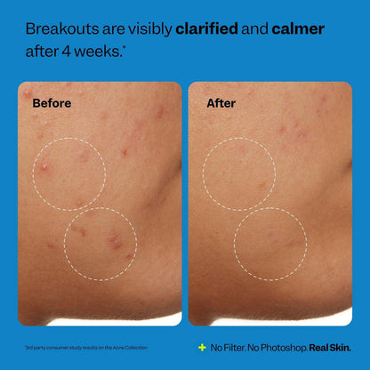 Peach Slices Acne Clarifying Cleanser