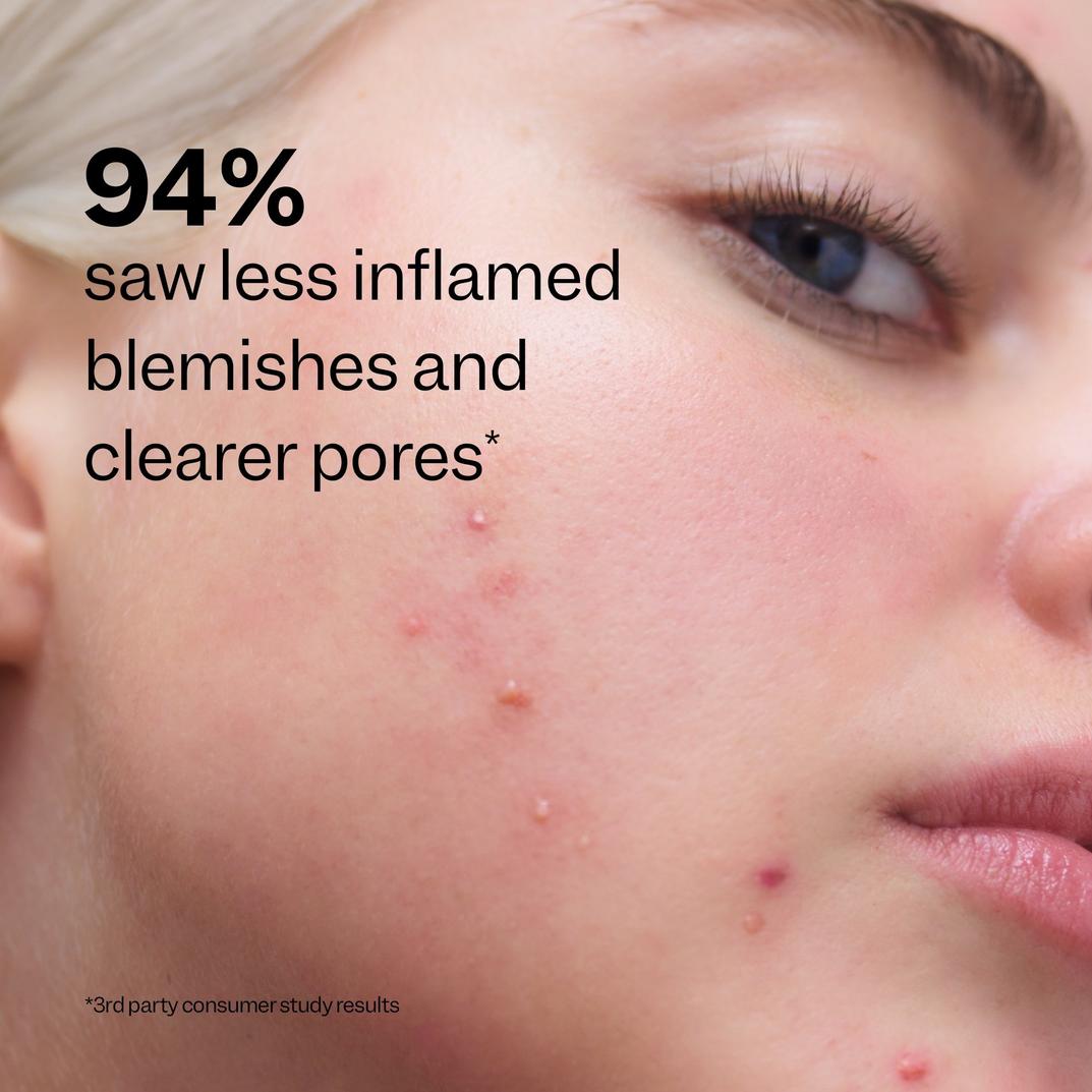 Peach Slices Acne Clarifying Cleanser