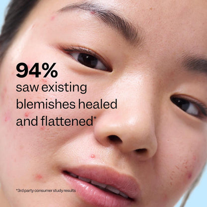 Peach Slices Acne Exfoliating Toner