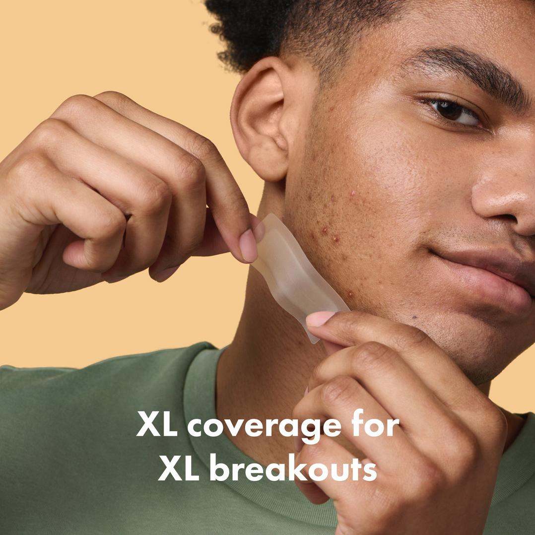 Hero Cosmetics Mighty Patch Surface Acne Pimple Patches