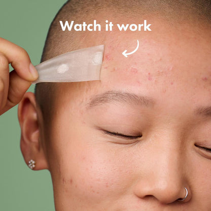 Hero Cosmetics Mighty Patch Surface Acne Pimple Patches