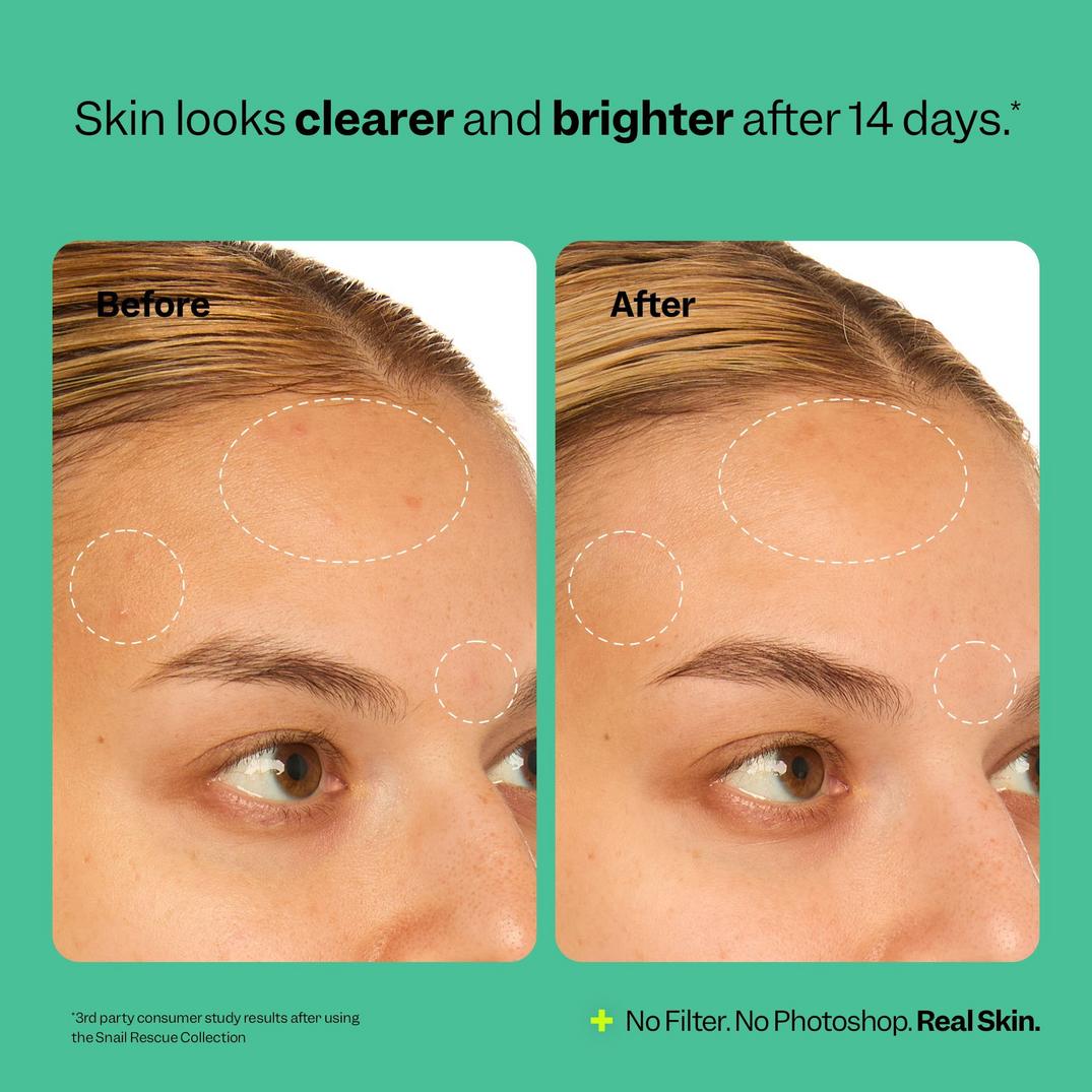 Peach Slices Snail Rescue Intensive Serum