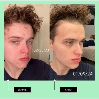 good light Order of the Eclipse Hyaluronic Cream