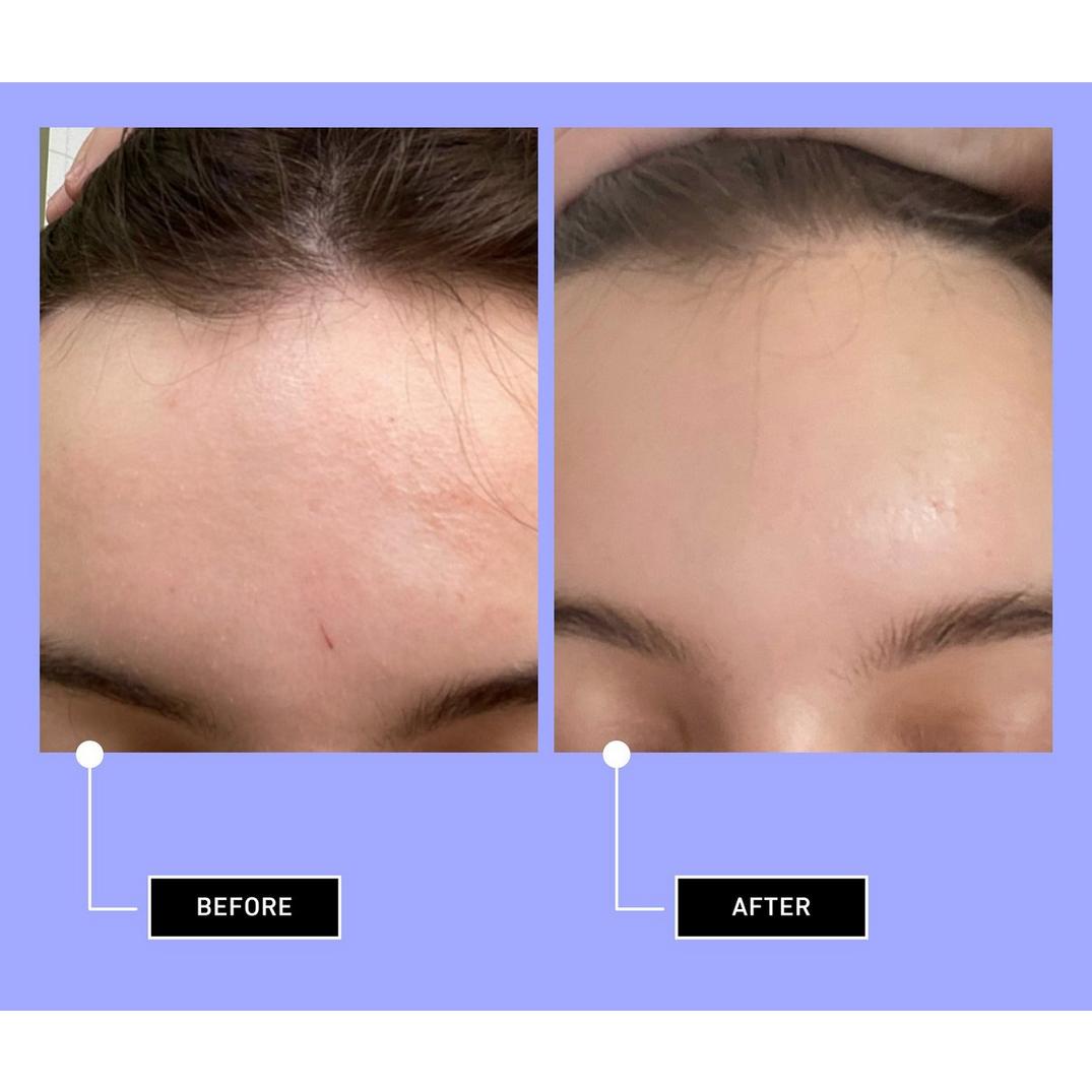 good light We Come In Peace Microbiome Serum