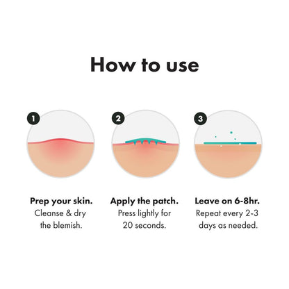 Hero Cosmetics Mighty Patch Micropoint for Blemishes Patches