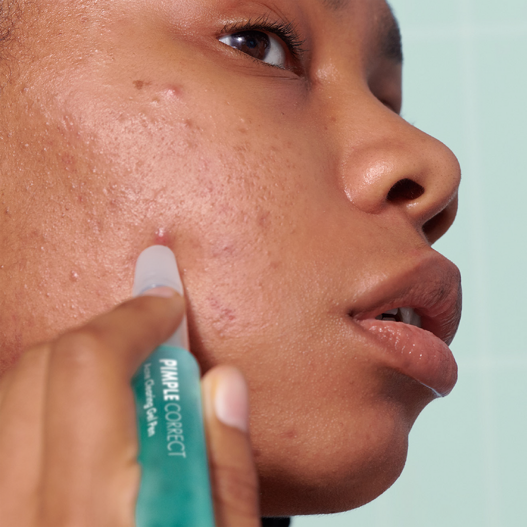 Hero Cosmetics Pimple Correct Acne Clearing Gel Pen