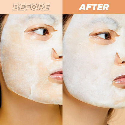I Dew Care Glow Up Bubbles Illuminating Bubbling Sheet Mask