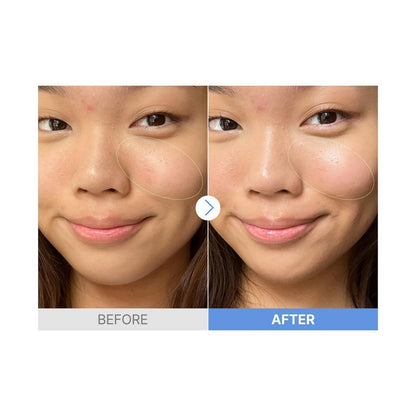 COSRX The Hyaluronic Acid 3 Serum with Amino Acids + Ceramide NP