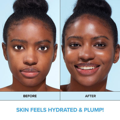 I Dew Care Hydra Vibes 8-Hyaluroinc Acid Moisturizer